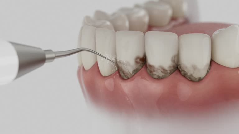 Reliable Dental contractor in Mabank, TX by Smile Center Dentistry